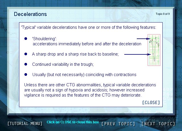 Sample CTG Tutor Screen - shot