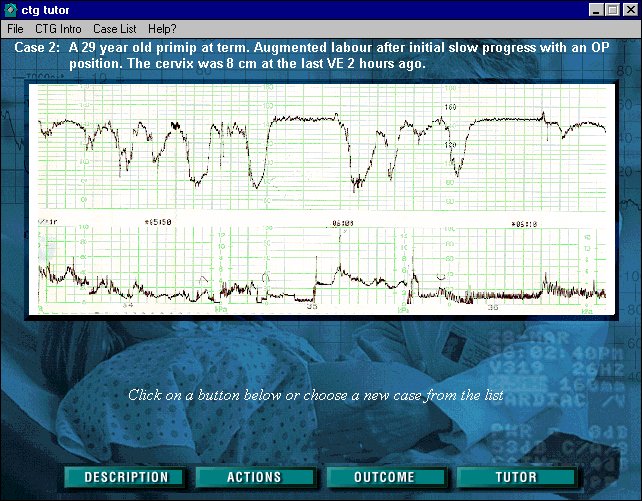 A Sample CTG Tutor Screen - Shot