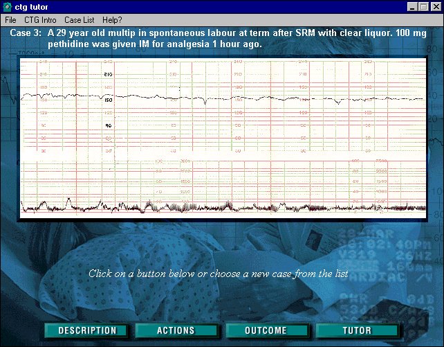 A Sample CTG Tutor Screen Shot