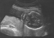 scan