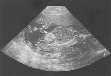 scan