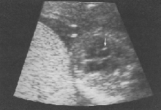 scan