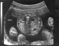 scan